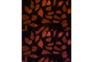 Immunofluorescence analysis of L929 cells using Legumain (Legumain (LGMN)) Polyclonal Antibody (ABIN6128201, ABIN6143172, ABIN6143173 and ABIN6214867) at dilution of 1:100 (40x lens). (LGMN anticorps  (AA 18-323))