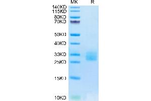 Biotinylated Human IL-25 on Tris-Bis PAGE under reduced condition. (IL-25 Protein (AA 33-177) (His-Avi Tag,Biotin))
