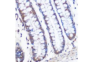 Immunohistochemistry of paraffin-embedded human colon using ERK5 Rabbit mAb (ABIN1680723, ABIN3018327, ABIN3018328 and ABIN7101595) at dilution of 1:100 (40x lens). (MAPK7 anticorps)