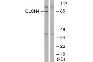 Western Blotting (WB) image for anti-Chloride Channel 4 (CLCN4) (Internal Region) antibody (ABIN1851086) (CLCN4 anticorps  (Internal Region))