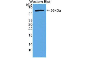 Western Blotting (WB) image for anti-Apoptosis Antagonizing Transcription Factor (AATF) (AA 273-477) antibody (ABIN2118436)