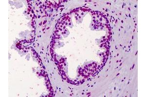 Human Prostate: Formalin-Fixed, Paraffin-Embedded (FFPE)