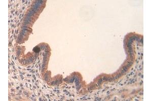 Detection of Slit3 in Mouse Uterus Tissue using Polyclonal Antibody to Slit Homolog 3 (Slit3) (SLIT3 anticorps  (AA 1348-1517))