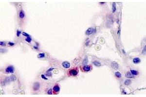 Human, Lung, Type 2 pneumocytes: Formalin-Fixed Paraffin-Embedded (FFPE) (Surfactant Protein C anticorps  (AA 144-173))