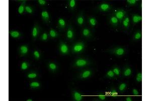 Immunofluorescence of monoclonal antibody to DDX56 on HeLa cell. (DDX56 anticorps  (AA 450-547))
