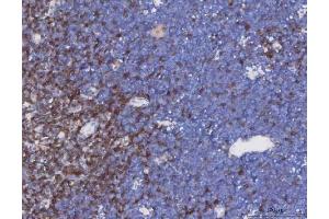 IHC analysis of TCR alpha/TRAC using anti-TCR alpha/TRAC antibody (ABIN6719654). (TRAC anticorps  (AA 1-114))