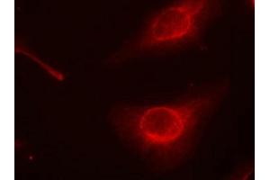 Immunofluorescence staining of methanol-fixed Hela cells using cofilin(Phospho-Ser3) Antibody.