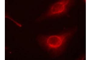 Immunofluorescence staining of methanol-fixed Hela cells using cofilin(Phospho-Ser3) Antibody. (Cofilin anticorps  (pSer3))