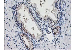 Immunohistochemical staining of paraffin-embedded Human prostate tissue using anti-PNMT mouse monoclonal antibody. (PNMT anticorps)