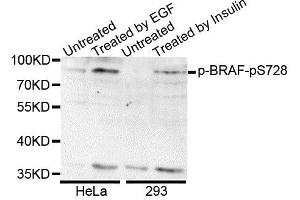 Western blot analysis of extracts of various cell lines, using Phospho-BRAF-S728 antibody. (BRAF anticorps  (pSer728))