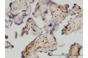Immunoperoxidase of monoclonal antibody to EXOSC8 on formalin-fixed paraffin-embedded human placenta.