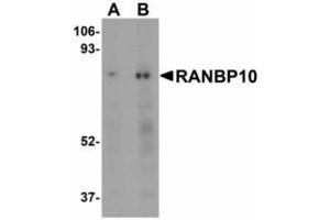 Image no. 1 for anti-RAN Binding Protein 10 (RANBP10) (Internal Region) antibody (ABIN478260) (RANBP10 anticorps  (Internal Region))
