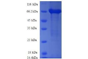 rho/rac Guanine Nucleotide Exchange Factor (GEF) 18 (ARHGEF18) (AA 159-551), (partial) protein (GST tag)