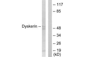 Western Blotting (WB) image for anti-Dyskeratosis Congenita 1, Dyskerin (DKC1) (Internal Region) antibody (ABIN1849014) (DKC1 anticorps  (Internal Region))