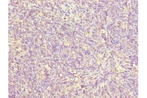 Immunohistochemistry of paraffin-embedded human thymus tissue using ABIN7176109 at dilution of 1:100 (ZNF131 anticorps  (AA 80-379))