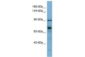 WB Suggested Anti-TMEM146 Antibody Titration: 0. (TMEM146 anticorps  (Middle Region))