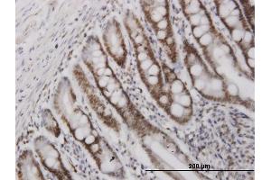 Immunoperoxidase of monoclonal antibody to HMGB2 on formalin-fixed paraffin-embedded human small Intestine. (HMGB2 anticorps  (AA 1-195))