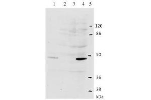 Western Blotting (WB) image for anti-Human Papilloma Virus Type 11 (HPV-11) (AA 202-284) antibody (ABIN781775) (Humain Papilloma Virus Type 11 (HPV-11) (AA 202-284) anticorps)
