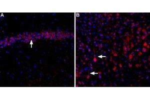 Expression of CaVα2δ3 in rat hippocampus and cortexImmunohistochemical staining of rat hippocampal CA3 region (A) and rat neocortex (B) using Anti-CACNA2D3 (CaVα2δ3) (extracellular)-ATTO Fluor-594 Antibody (ABIN7582011).