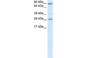 WB Suggested Anti-BCL2 Antibody Titration:  0. (Bcl-2 anticorps  (N-Term))