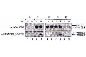 FA-D2 fibroblasts were stably transfected with either pMMP (empty vector, A), FANCD2 (wt, B), FANCD2 (S222A, C), FANCD2 (triple mutant, D), or FANCD2 (quadruple mutant, E). (FANCD2 anticorps  (pSer222))
