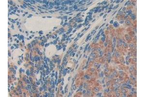 DAB staining on IHC-P; Samples: Mouse Ovary Tissue