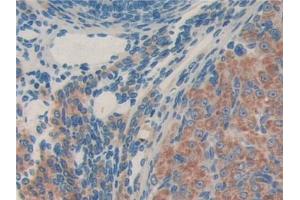 DAB staining on IHC-P; Samples: Mouse Ovary Tissue (MTA1 anticorps  (AA 6-218))