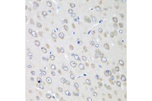 Immunohistochemistry of paraffin-embedded rat brain using RPN2 antibody (ABIN5974836) at dilution of 1/100 (40x lens). (Ribophorin II anticorps)