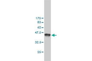 Western Blot detection against Immunogen (36. (MSH6 anticorps  (AA 931-1030))