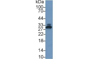 Detection of CRP in Rat Serum using Polyclonal Antibody to C Reactive Protein (CRP) (CRP anticorps  (AA 20-225))