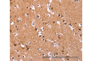 Immunohistochemistry of Human brain  using ICAM5 Polyclonal Antibody at dilution of 1:25 (ICAM5 anticorps)