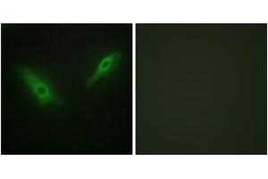 Immunofluorescence analysis of HeLa cells, using KPB1/2 Antibody. (KPB1/2 (AA 31-80) anticorps)