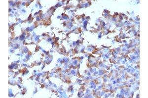 Formalin-fixed, paraffin-embedded human Histiocytoma stained with CD163-Monospecific Mouse Monoclonal Antibody (M130/2162). (CD163 anticorps  (AA 43-196))