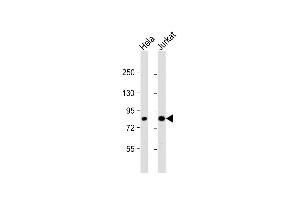 All lanes : Anti-CHUK Antibody (C-term) at 1:1000 dilution Lane 1: Hela whole cell lysate Lane 2: Jurkat whole cell lysate Lysates/proteins at 20 μg per lane. (IKK alpha anticorps  (C-Term))