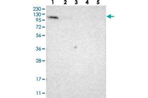 Western blot analysis of Lane 1: RT-4, Lane 2: U-251 MG, Lane 3: Human Plasma, Lane 4: Liver, Lane 5: Tonsil with LONP2 polyclonal antibody . (LONP2 anticorps)