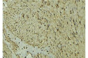 ABIN6277295 at 1/100 staining Mouse muscle tissue by IHC-P. (MEF2C anticorps  (C-Term))