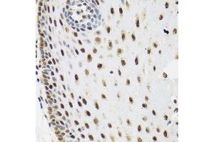 Immunohistochemistry of paraffin-embedded human esophagus using SKIV2L2 antibody.