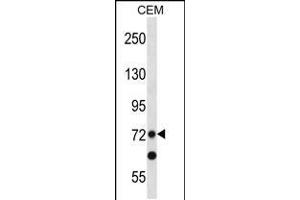Western blot analysis in CEM cell line lysates (35ug/lane). (PRDM8 anticorps  (N-Term))