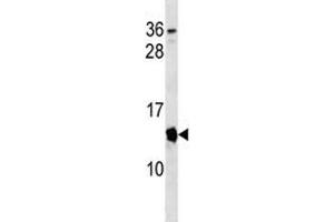Cdkn2a antibody western blot analysis in mouse spleen tissue lysate. (CDKN2A anticorps  (AA 39-65))