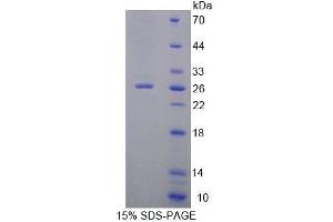 SDS-PAGE analysis of Human ZRF1 Protein. (DNAJC2 Protéine)