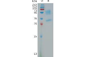 Human PR Protein, hFc Tag on SDS-PAGE under reducing condition.