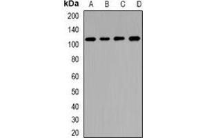 Western blot analysis of CNGA3 expression in BT474 (A), U87 (B), mouse pancreas (C), rat liver (D) whole cell lysates. (CNGA3 anticorps)