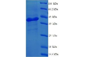 SDS-PAGE (SDS) image for Complement Component 1, Q Subcomponent, A Chain (C1QA) (AA 23-245) protein (His-SUMO Tag) (ABIN5709163)