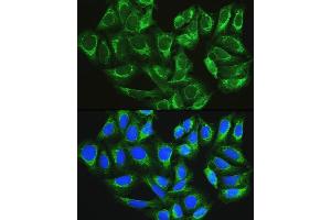 Immunofluorescence analysis of U2OS cells using L1 antibody (ABIN6134555, ABIN6137248, ABIN6137250 and ABIN6215529) at dilution of 1:100.