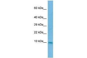 WB Suggested Anti-CC2D2A Antibody Titration: 1. (CC2D2A anticorps  (N-Term))