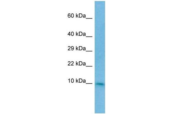 CC2D2A anticorps  (N-Term)