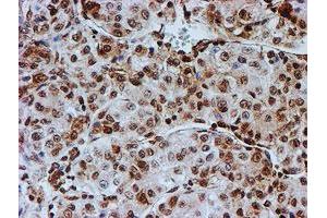 Image no. 7 for anti-Fragile X Mental Retardation 1 (FMR1) antibody (ABIN1498287)