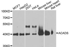 Western blot analysis of extracts of various cell lines, using ACADS antibody (ABIN5970342) at 1/1000 dilution. (ACADS anticorps)