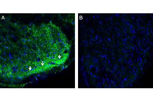 Expression of CRMP2 in rat spinal cord.