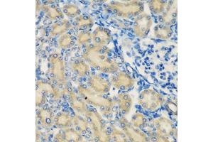 Immunohistochemistry of paraffin-embedded rat kidney using C1S antibody (ABIN5974143) at dilution of 1/200 (40x lens). (C1S anticorps)